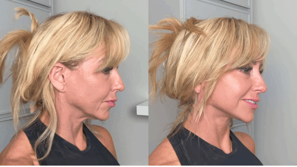 Chalene face lift tape
