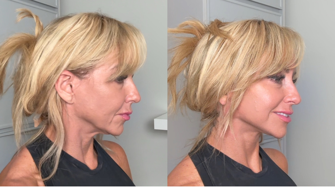 Chalene face lift tape