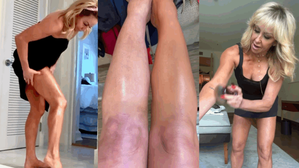 Chalene Body Blur for Cellulite