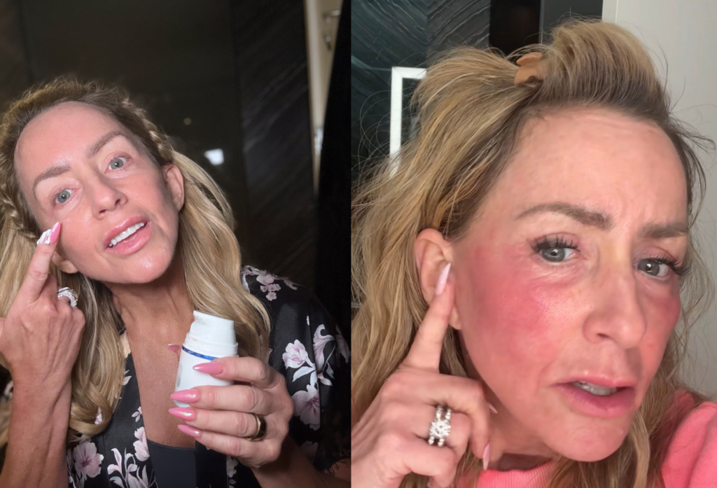3 step skincare over 40