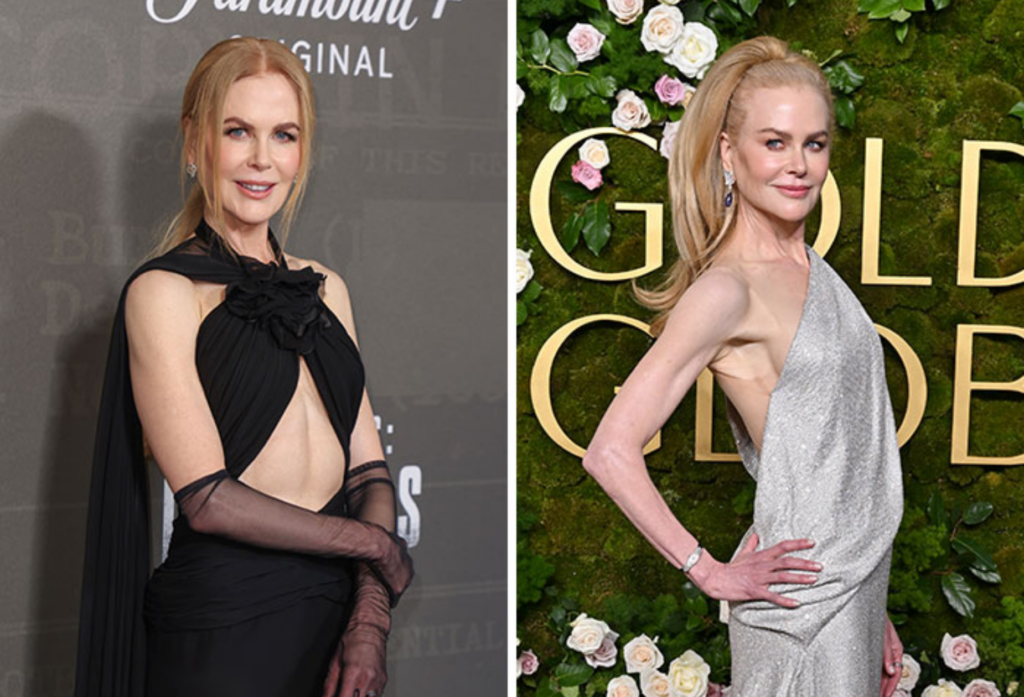 Side-by-side red carpet photos showing a dramatic change in body composition, illustrating the difference between weight loss and maintaining muscle mass.
